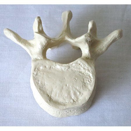 DENOYER-GEPPERT Anatomical Model, Lumbar Vertebra SB15